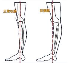 反帳膝