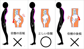 下腹ポッコリ姿勢